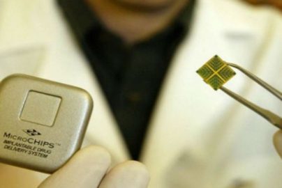 microchip-true-activist-photocredit-activistpost-com