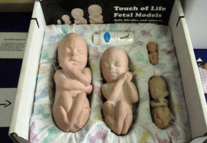Screenshot - 7_25_2018 , 12_30_06 AM pro life fetal models