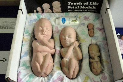 Screenshot - 7_25_2018 , 12_30_06 AM pro life fetal models