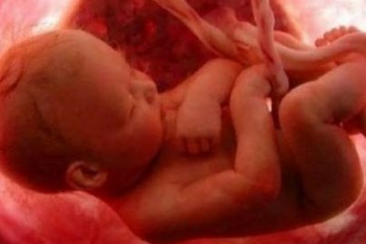 aborted-baby-churchmilitant-com