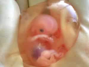 aborted-fetal-tissue-2021-truth