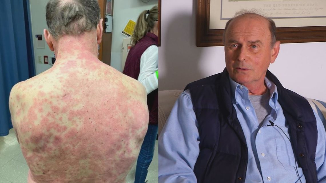 covid-vaccine-reactions-wgntv-com-2021-truth