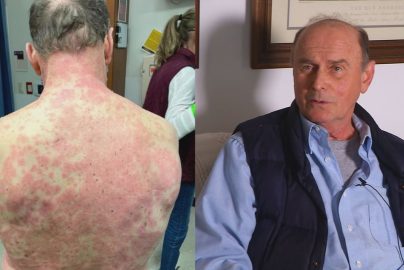 covid-vaccine-reactions-wgntv-com-2021-truth