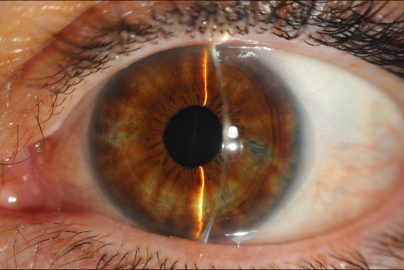 minority-report-eye-laser-thelancet-com-2021-sci-fi-reality-truth