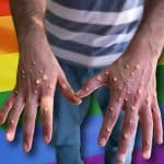 LGBTQ-Rainbow-Flag-Monkeypox-Hands-newstarget-com-2022-truth