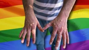 LGBTQ-Rainbow-Flag-Monkeypox-Hands-newstarget-com-2022-truth