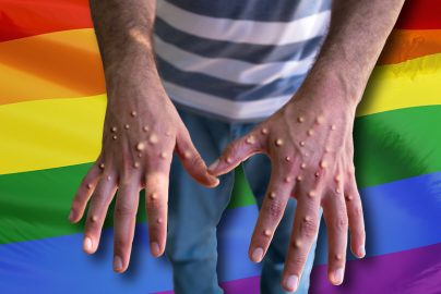 LGBTQ-Rainbow-Flag-Monkeypox-Hands-newstarget-com-2022-truth