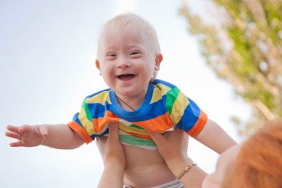 baby-down-syndrome-familydoctor-org-2022-truth