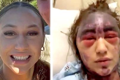 alexis-lorenze-vaccines-hospital-feature-2024-truth